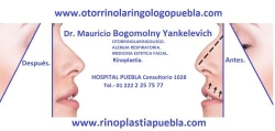 Horario de apertura Otorrinolaringologo Puebla, 