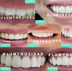 Horario de apertura Lumy Dental Querétaro Centro Histórico,