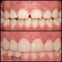 Horario de apertura Dentista Optident, Xalapa Enríquez