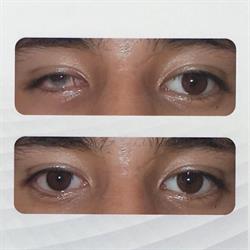 Protesis Oculares, Ojos Artificiales en Ciudad de México (Roma Sur) - Horario de apertura