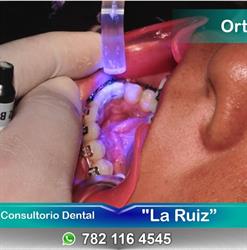 Horario de apertura Consultorio Dental " La Ruiz ", Coatzintla