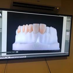 Laboratorio dental Blanco en Ciudad Nezahualcóyotl (Reforma) - Horario de apertura